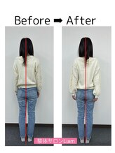 リアン(Liam)/全身ケア整体　before/after