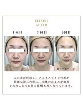 リリーオン 福岡店(RILLEE-ON)/１回目→３回目→６回目