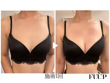 フーアップ 北千住(FU-UP)/バストアップ/育乳（1回）