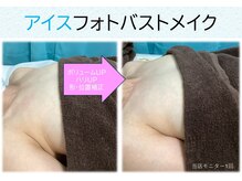 ブロッサム(BLOSSOM)/アイスフォトバストメイク