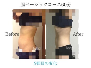 リープル(Leapl)/【腸もみ】腸もみ後の変化写真