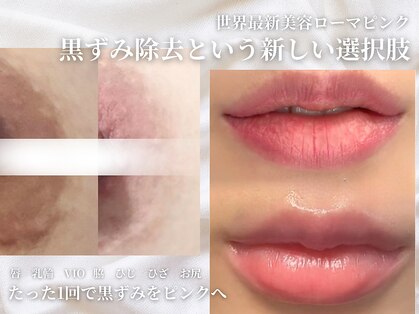 ウィラレア(UILALEA)の写真