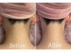 ビューティービレッジ(Beauty village)の写真
