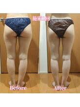 ヨサパーク サーナ 仙川(YOSA PARK Sana)/20代お客様ビフォー⇒アフター