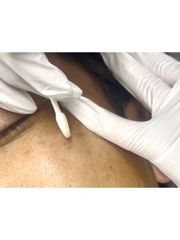 シミしわ改善！予防ケア