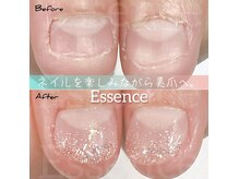 エッセンス (Essence)の雰囲気（深爪,むしり癖など改善し、美爪へ導く施術をあなたにも。）