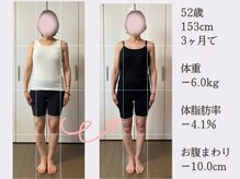 香林(KARIN)/ビフォーアフター