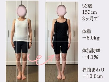 香林(KARIN)/ビフォーアフター