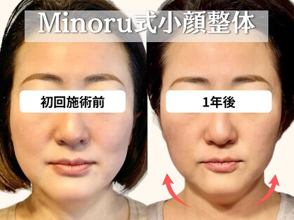 フレキシボディ(FlexiBody)の写真