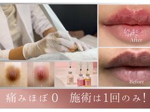 ウェルビー(Well-Be)の雰囲気（話題のルメラで圧倒的トーンアップ★デリケートな黒ずみに◎）