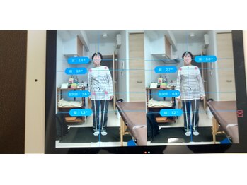 彩(イロドリ)/治療後のbefore after