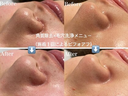 リゲルス(Regel)の写真