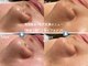 リゲルス(Regel)の写真