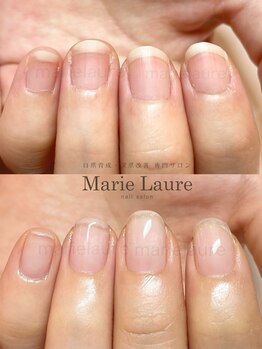 マリーロール 天王寺店(Marie Laure)/深爪矯正/自爪育成/ネイルケア/