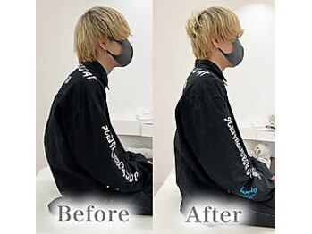 アマテル(AMATERU)/Before/After7