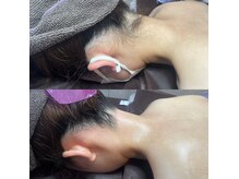 エルモロアブラジリアンワックス(ElmoRois BrazilianWax)の雰囲気（うなじ＋もみあげ脱毛は暑い時期に必須！スッキリ後ろ姿◎）