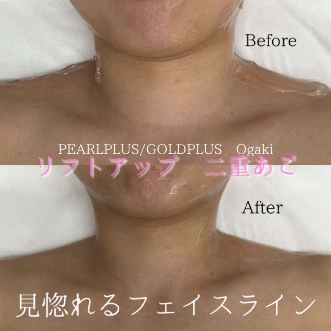 なな様先日パール入れる