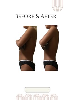 ヨサパーク ゴールデンツリー 浦安本店(YOSA PARK GordenTree)/1ヶ月でこの効果♪