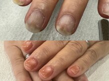 レヴィア(REVIA)の雰囲気（自爪育成コース、縦割れのお悩みにオススメ）