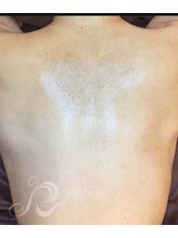 リン 長崎 大村(Rin)/ブライダル前もご相談ください♪