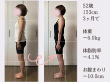 香林(KARIN)/ビフォーアフター