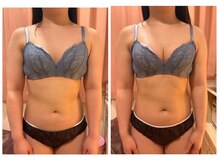 レイビス 仙台店(RAYVIS)/ふわふわマシュマロバスト1