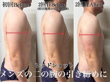 アンドエス 六本木(and S.)/レッドショット二の腕引き締め☆