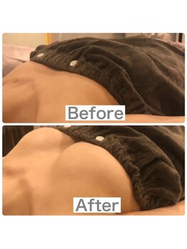 リリーパッソ(Lily passo)/