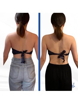 デール(R:DeeL)/ブライダルエステはこれ