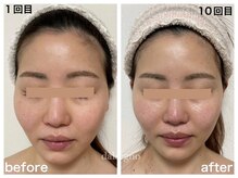 ダルセーニョ/輪郭！パーツが本来の正位置に！