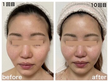 ダルセーニョ/輪郭！パーツが本来の正位置に！