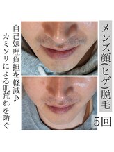 アースコアフュールボーテ ひたち野うしく店(EARTH coiffure beaute)/メンズ→ヒゲ脱毛、顔脱毛♪