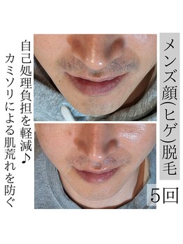 アースコアフュールボーテ ひたち野うしく店(EARTH coiffure beaute)/メンズ→ヒゲ脱毛、顔脱毛♪