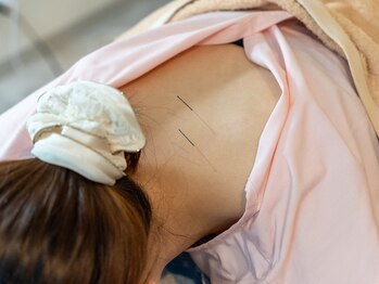 ヴェッセル(Vessel)/