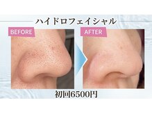ディシェーレ アストの雰囲気（たまご肌◎ハイドロフェイシャル￥13000→）