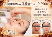 イーズ ミュゼ  ららぽーと横浜店