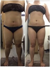 ビューティーワークスシャンティ 柏店(Beauty Works Shanti)/6ヶ月でー9.8Kg！！1枚目