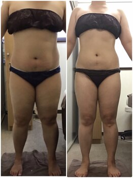 ビューティーワークスシャンティ 柏店(Beauty Works Shanti)/6ヶ月でー9.8Kg！！1枚目