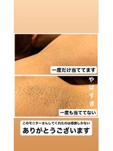 ケアアネラ(KeaAnela)/１度の脱毛で効果がわかる！