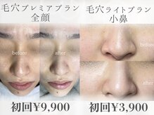 ニーズ(NIEES)