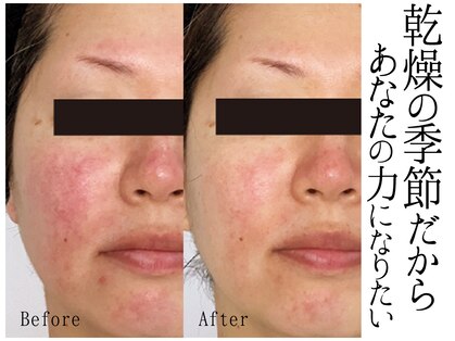 スポット 薬院駅前店(SPOT)の写真