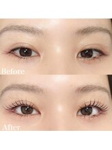 レピア 郡山駅前店/韓国式LEPIA Before&After