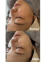 ニコ(nico)/透明感ってこういうこと。