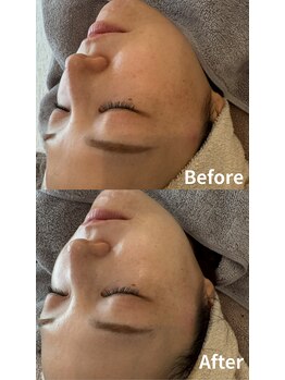 ニコ(nico)/透明感ってこういうこと。