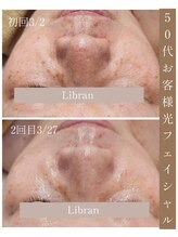 リブラン(Libran)/目の下のハリ、シミ変化☆