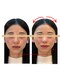 東麻布アマン(東麻布Aman)の写真/完全個室で美容鍼！小顔や小頭の魅力へ導く美容ケア。結果を大切にする保証で納得♪