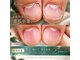 エッセンス (Essence)の写真