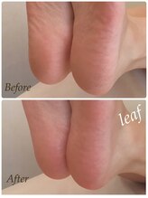 プライベートサロン リーフ(Privatesalon leaf)/かかとツルツル！フットケア♪