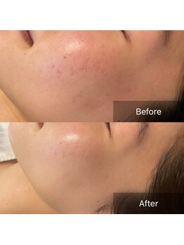 サロン ド ナビ 岡山店(Salon de NABI)/クリスティーナ イラストリアス