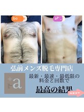 メンズ プラス アルファ(Mens plus a+)/全身脱毛で清潔感UP！モテる！